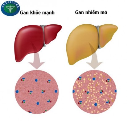 Gan Và Những Bệnh Thường Gặp