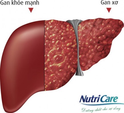 Gan Và Những Bệnh Thường Gặp