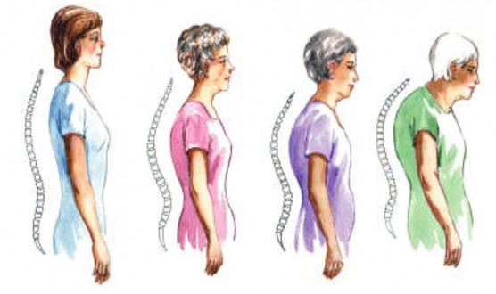  width=