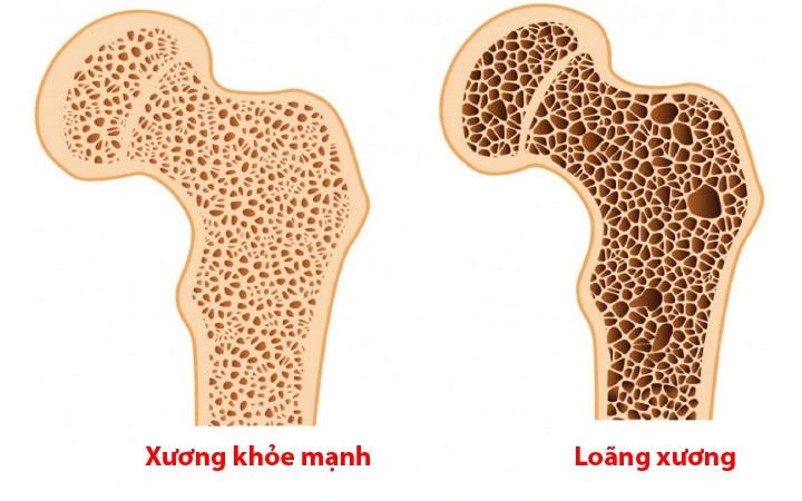  width=