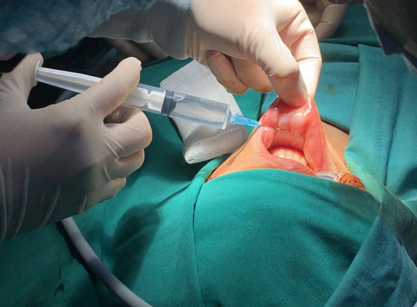 Phẫu thuật bệnh nhân u tuyến giáp