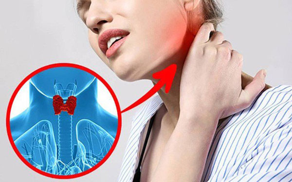 U tuyến giáp ở trước cổ bệnh nhân