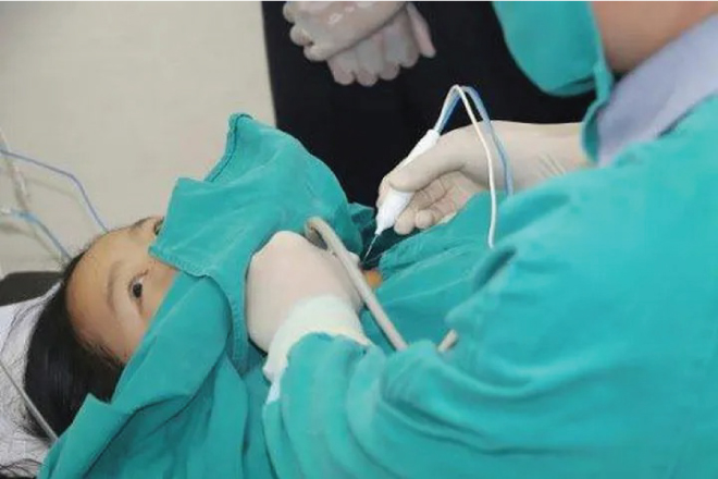 Kỹ thuật đốt sóng cao tần điều trị u tuyến giáp tirads 4