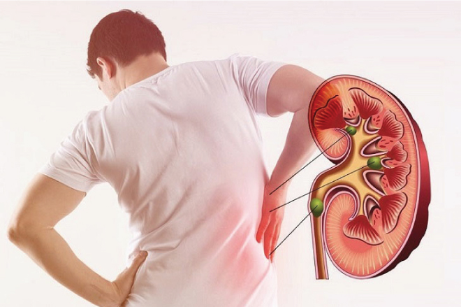 Suy thận là một hậu quả của tiểu đường