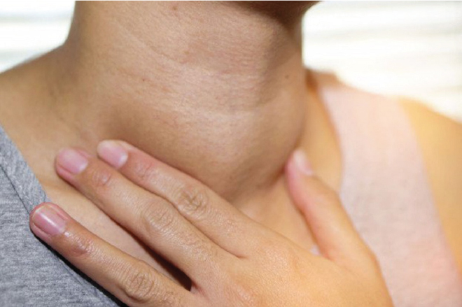 U tuyến giáp tirads 4 khiến vùng cổ bệnh nhân sưng to