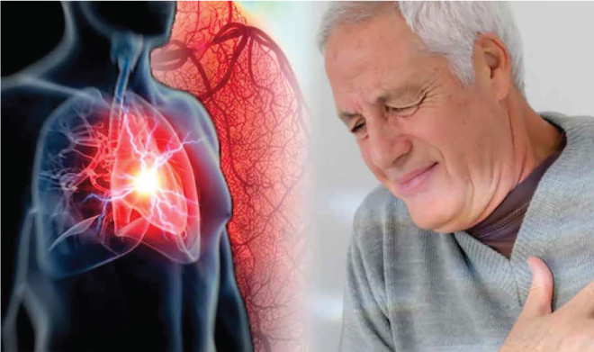Trứng vịt lộn làm tăng nguy cơ nhồi máu cơ tim và đột quỵ ở người sau phẫu thuật mắc bệnh tim