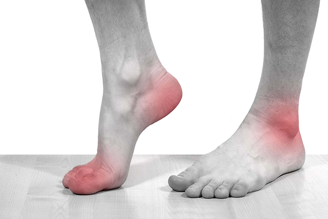 Người bệnh Gout