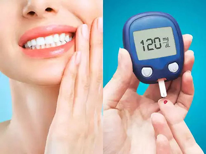 Bệnh lý răng miệng