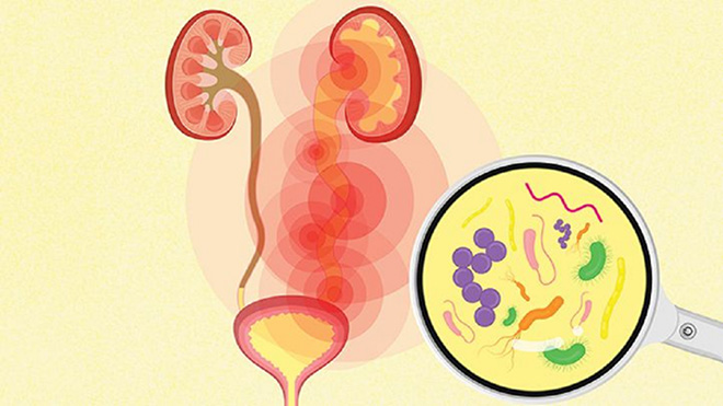 Biến chứng nhiễm trùng của tiểu đường