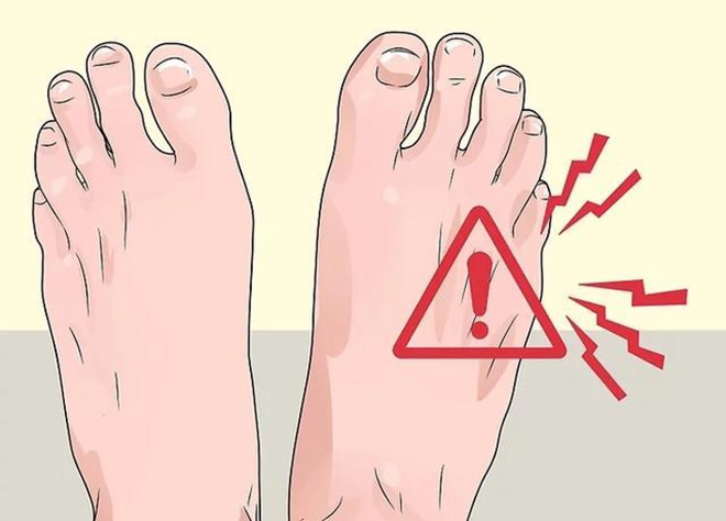 Biến chứng bàn chân tiểu đường