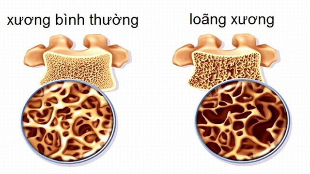 Nhiều yếu tố về bệnh và thuốc
