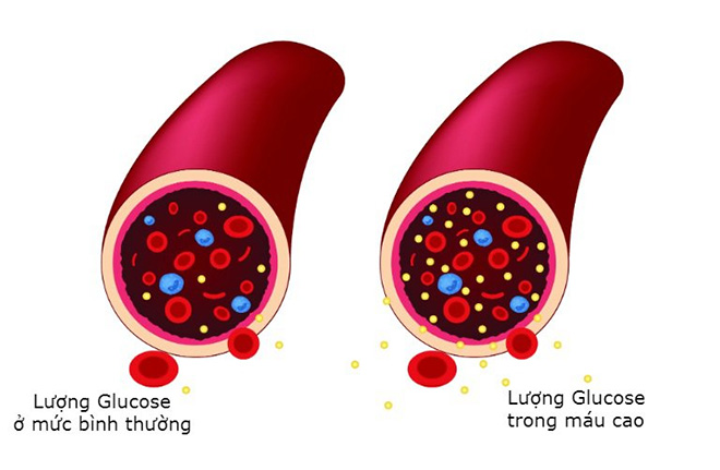 Glucose