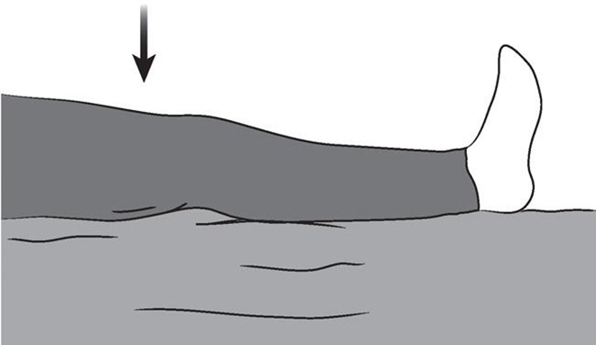 Bài tập co cơ tĩnh (co cơ tứ đầu đùi)