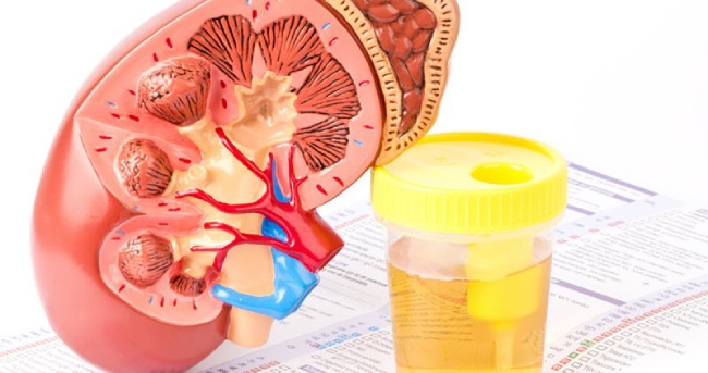 Xét nghiệm bệnh nhân tiểu đường