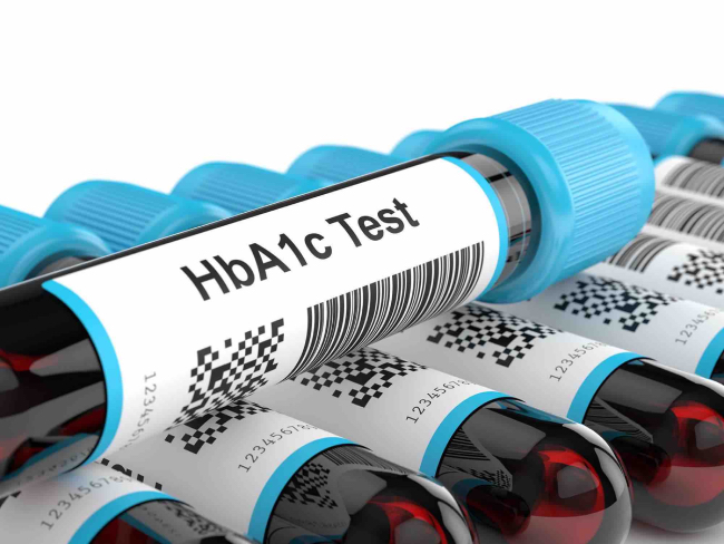 Xét nghiệm HbA1c