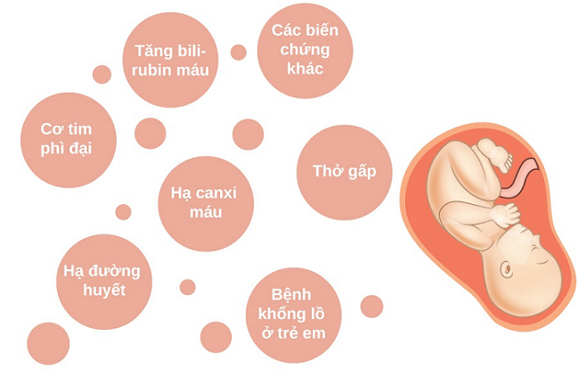Tiểu đường thai kỳ ảnh hưởng tới thai nhi