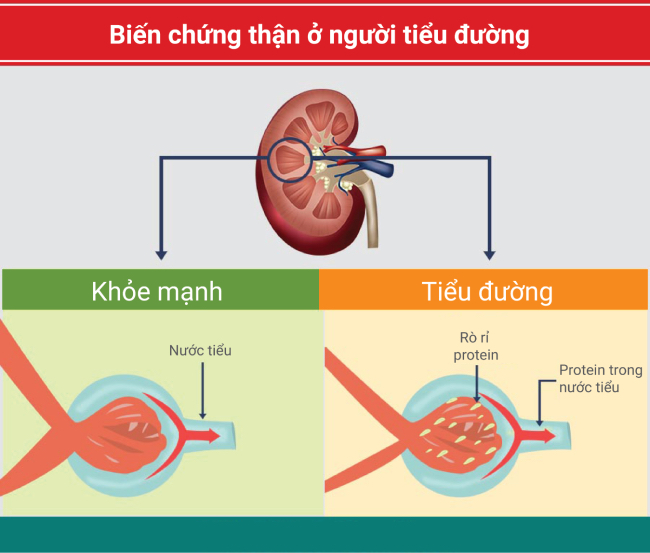 Các tổn thương ở thận