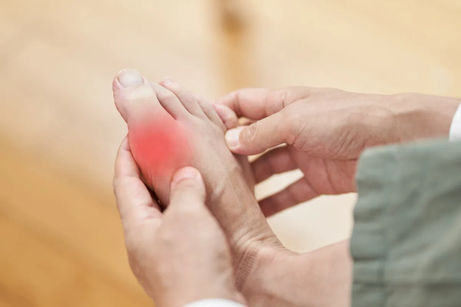 Người tiểu đường mắc bệnh gout cần tránh tiêu thụ cá