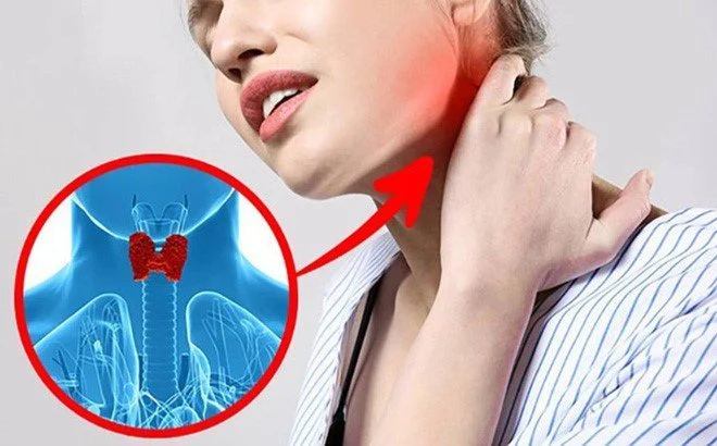 Người bệnh tiểu đường bị tuyến giáp nên hạn chế ăn bắp cải 